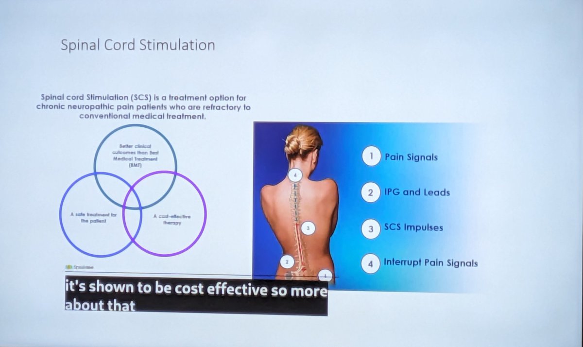 Spinal cord stimulation is emerging as an effective and cost-effective treatment for chronic pain, yet few people are receiving it, says Dr Simon Thomson of @thelondonclinic