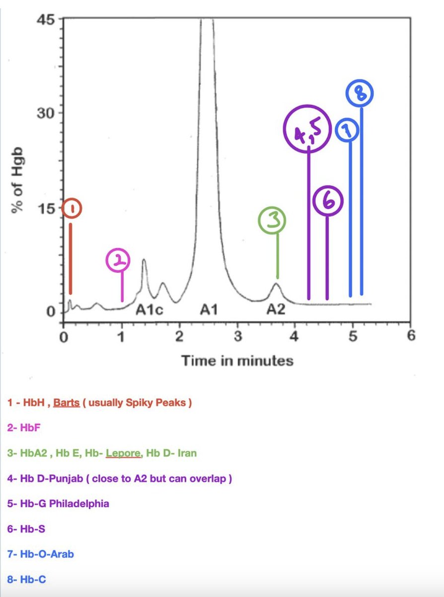 MorphologyAmigo's tweet photo. Different Hb Elution's on Standard HPLC👇
Good For Exam ReCall When Under Stress 🥸
Who uses BioRads anymore you Wonder��
Clearly still an Exam fav!😀
#hematology #MedX #medtwitter #medicine https://t.co/gdnAgfTdVx