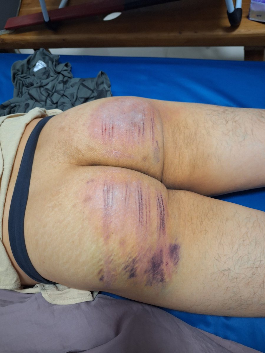 12下鞭刑藤條後一天，外加重板子回鍋🥲謝謝主人
我知錯了但還敢🤪
<a href="/wwwSWMan/">Scaning</a>