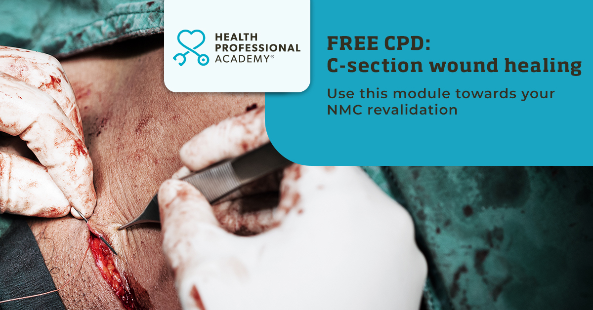 FOR MIDWIFERY & MATERNITY PROFESSIONALS 📣 Do you understand why some women are at greater risk of surgical site infections than others? Increase your knowledge with this free CPD module & use it towards your NMC revalidation 👉 healthprofessionalacademy.co.uk/cpd/casearean-… [AD]