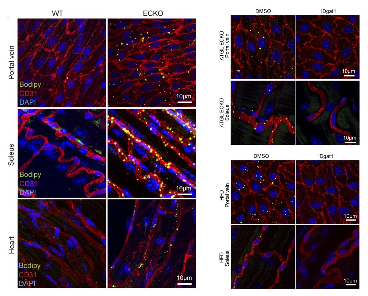 NAVBO (@vascularbiology) on Twitter photo #NAVBO Member Publication Alert
Endothelial lipid droplets suppress eNOS to link high fat consumption to blood pressure elevation
Zoltan Arany group <a href="/jclinicalinvest/">Journal of Clinical Investigation</a> 2023 <a href="/BoaKim5/">Boa Kim</a> <a href="/WencaoZhao/">Wencao Zhao</a> <a href="/FitzGerald__Lab/">The FitzGerald Lab</a> <a href="/AranyLab/">The Arany lab</a>
jci.org/articles/view/… #NAVBO Member Publication Alert
Endothelial lipid droplets suppress eNOS to link high fat consumption to blood pressure elevation
Zoltan Arany group <a href="/jclinicalinvest/">Journal of Clinical Investigation</a> 2023 <a href="/BoaKim5/">Boa Kim</a> <a href="/WencaoZhao/">Wencao Zhao</a> <a href="/FitzGerald__Lab/">The FitzGerald Lab</a> <a href="/AranyLab/">The Arany lab</a>
jci.org/articles/view/…