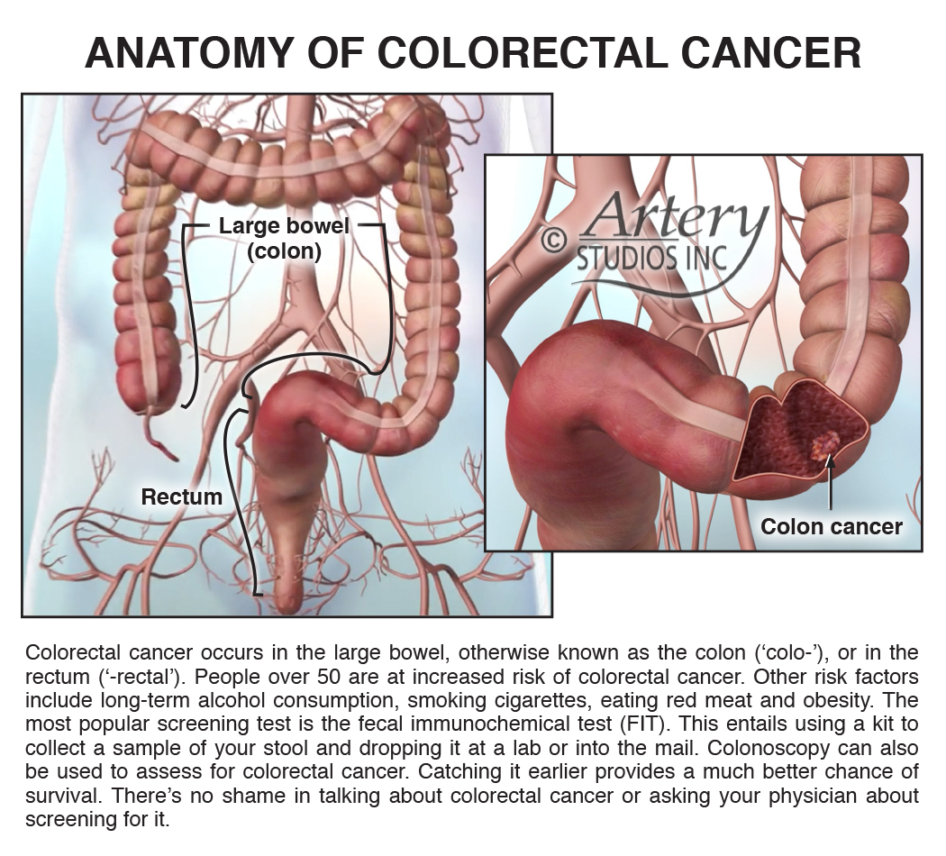 March is Colorectal Cancer Awareness Month