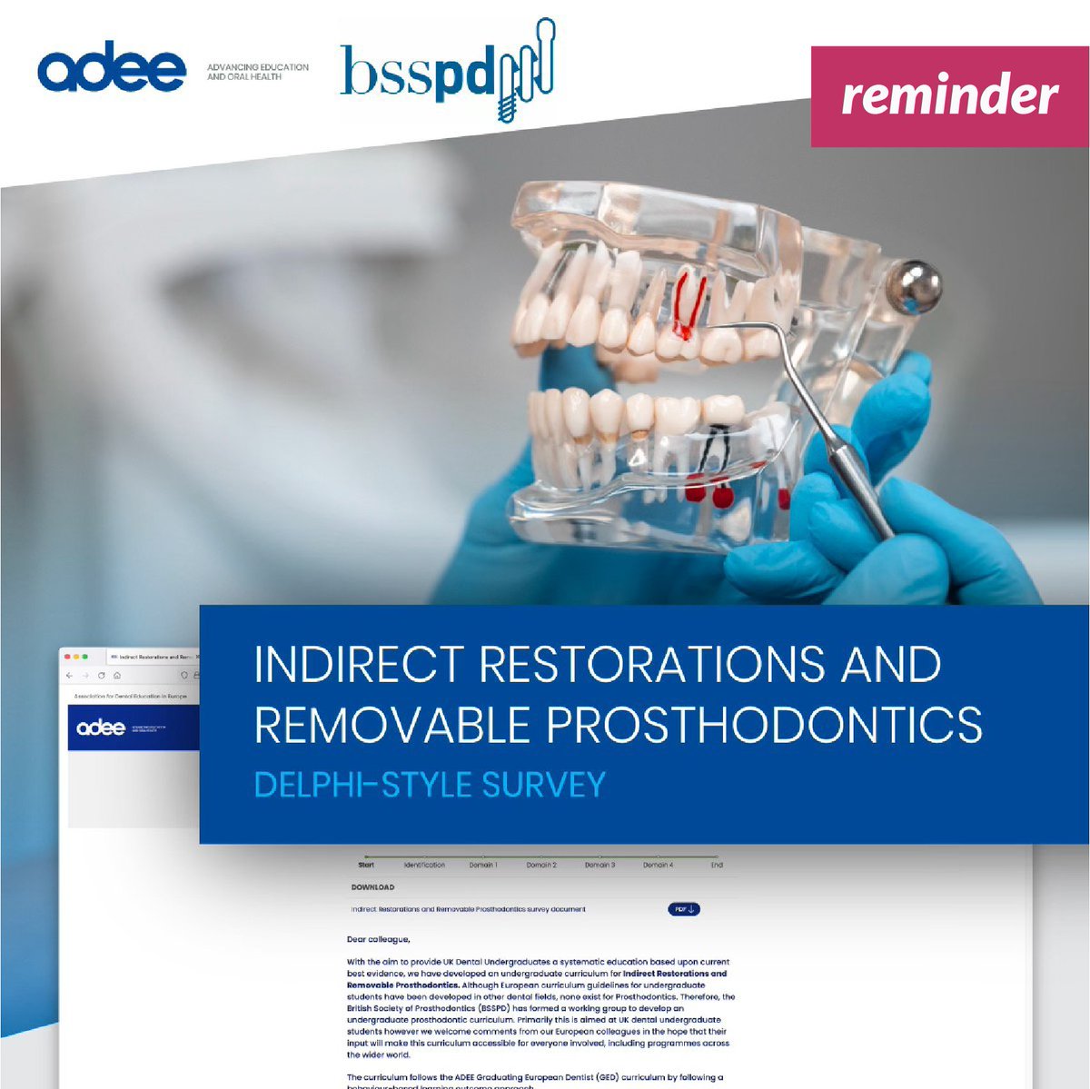 Reminder: Join the dental education revolution with BSSPD! Take our survey on Indirect Restorations and Removable Prosthodontics: adee.org/indirect-resto… #Adee #ElevateDentalEd #BSSPDRevolution #GlobalDentalInsights #Prosthodontics #Proscurriculum