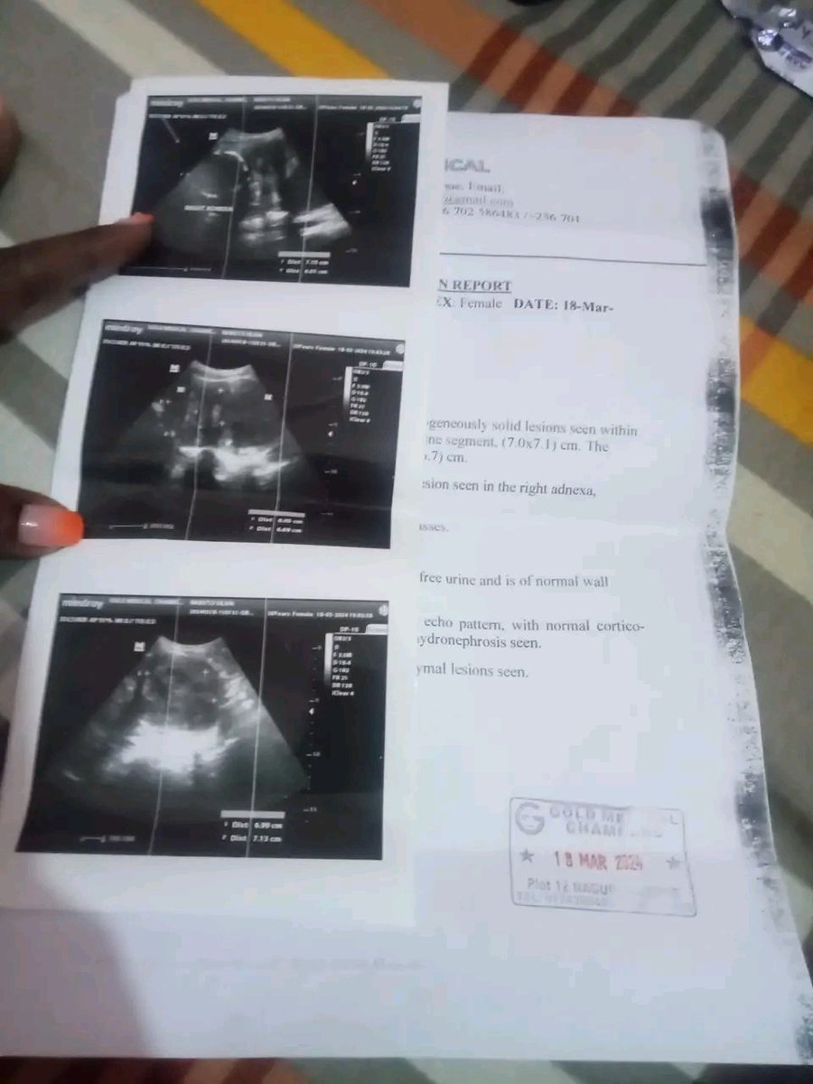 Phiona Kyeru tweet media