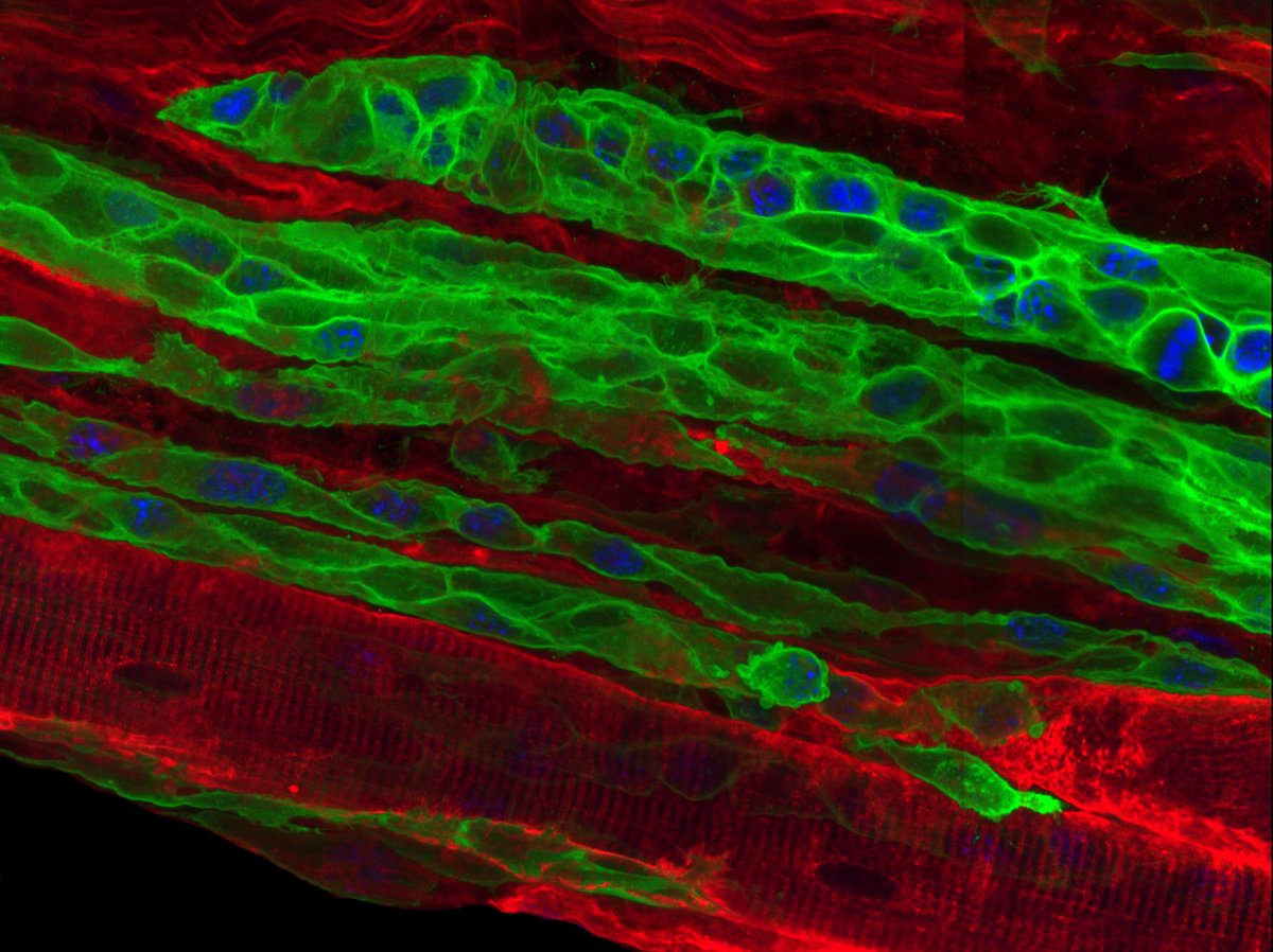 Gabrielle Kardon (@gabkardon) on Twitter photo Interested in stem cells, development, or regeneration? Join the Kardon Lab <a href="/UUtah/">University of Utah</a>! Looking for lab technician. Details at kardonlab.org/news Please RT. <a href="/SocDevBio/">Society for Developmental Biology</a> #myotwitter Interested in stem cells, development, or regeneration? Join the Kardon Lab <a href="/UUtah/">University of Utah</a>! Looking for lab technician. Details at kardonlab.org/news Please RT. <a href="/SocDevBio/">Society for Developmental Biology</a> #myotwitter