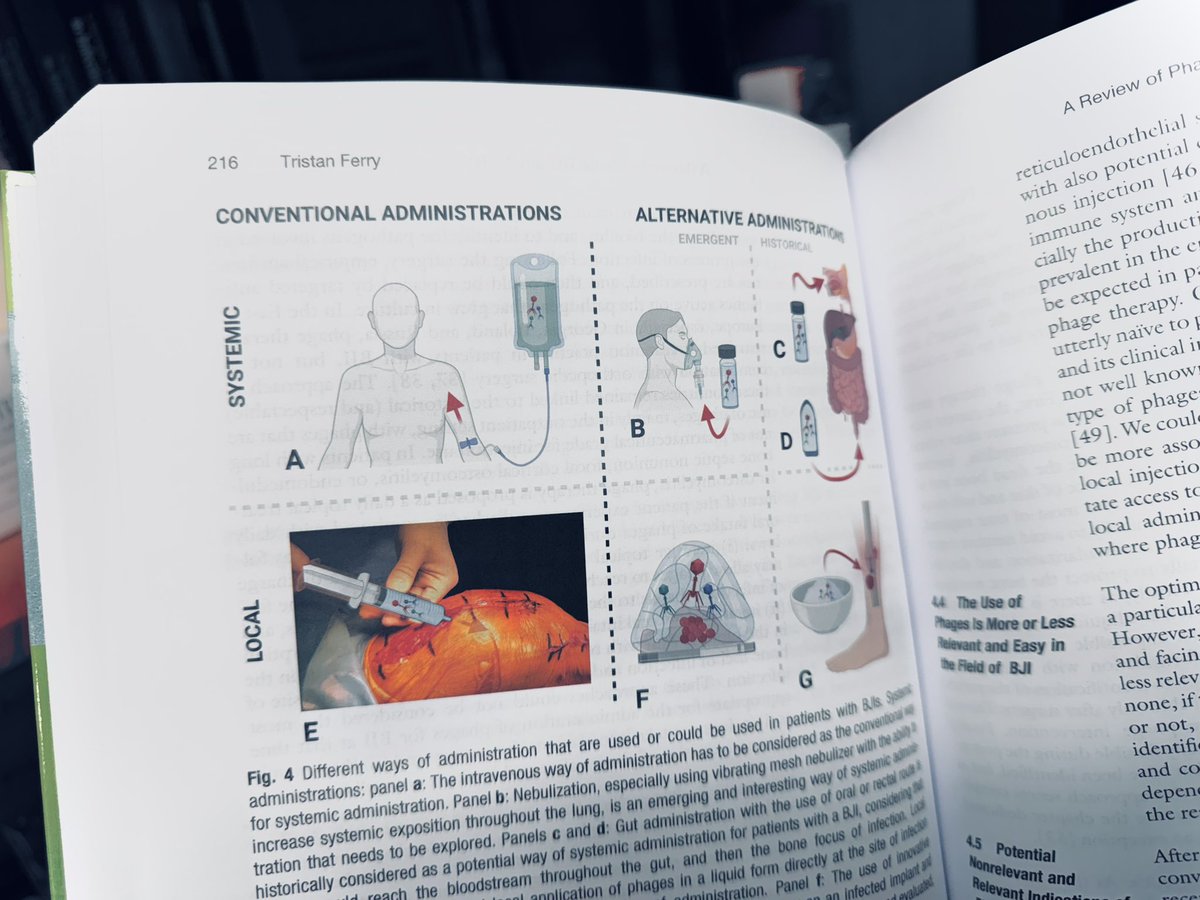 FerryLyon's tweet image. ✨ Very pleased to have contributed to this new #phagetherapy bible 📗➡️ link.springer.com/book/10.1007/9…! This long-awaited second edition of the acclaimed &quot;Bacteriophage Therapy; From Lab to Clinical Practice&quot; edited by Sanna Sillankorva and Joana Azeredo @azeredo_joana details…