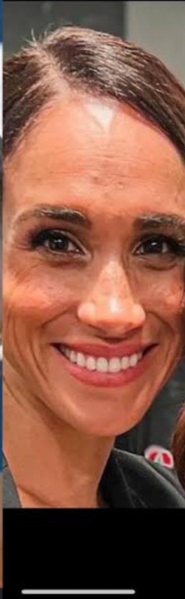 iradomii's tweet photo. @beabea10 @LadyEclairBunny @DannyDutch LMAO. PoW is gorgeous even in bad light. A future Queen.

Your MM? After surgery, eyelift, botox, veneers, spray tan, photoshop, and camera filters she is v common and IRRELEVANT. 😂🤣🤣😂
 #BotoxFail 
#MeghanMarkleAmericanPsycho https://t.co/x3ejEITukw