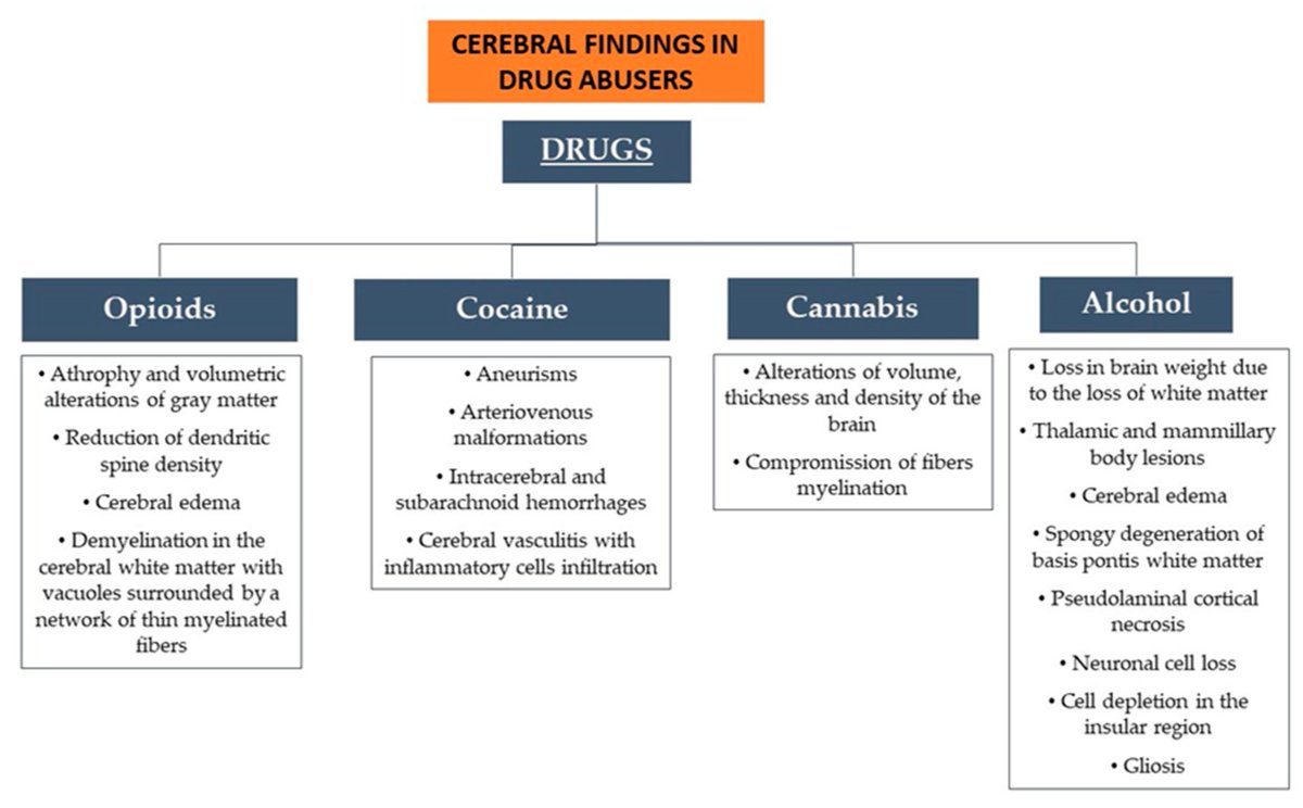 Biomed_MDPI's tweet photo. Recent Publication in #Drug and #alcohol Abusers,  read the Point of View of the Forensic Pathologist：
https://t.co/s0Zi37xfeJ

Main brain findings for the drugs examined↓↓↓ https://t.co/C7jAYDwHvb