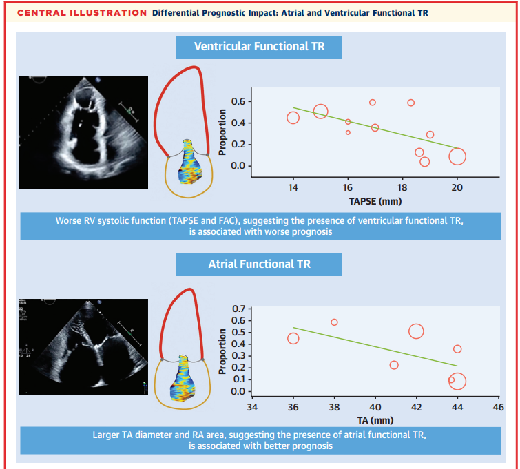 How important is phenotyping secondary TR in clinical practice? Check it out in our manuscript sciencedirect.com/science/articl… and on the editorial by @lpbadano and @denisamuraru sciencedirect.com/science/articl… @ErbertoC @sarabombace @PhilippLurz @p_grayburn @AnnaSannino1985