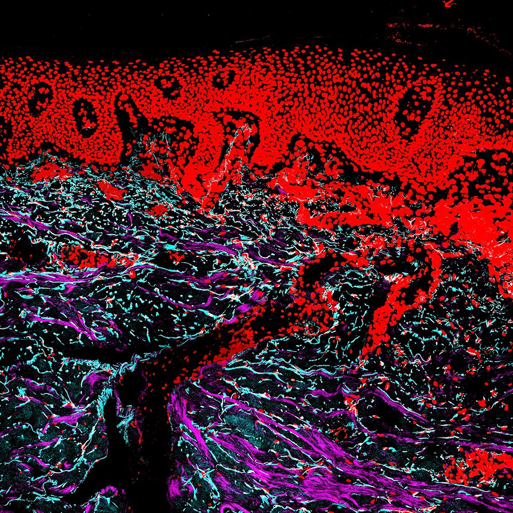 A joint work between the Wennemers group #DCHAB & the @WernerLabETH @ETH_DBIOL (SKINTEGRITY. CH project), presents a new #chemicalsensor that visualizes #collagen remodeling during wound healing in mice & humans. Learn more: doi.org/10.1016/j.matb… biol.ethz.ch/en/news-and-ev…