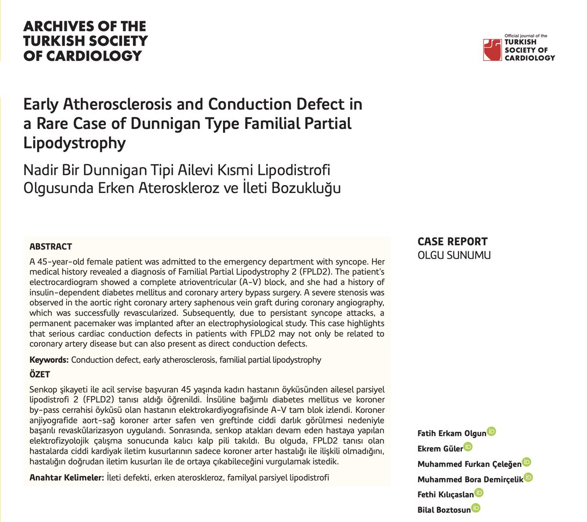 MeralKayikcoglu's tweet photo. Critical reminder: #Lipodystrophy, especially partial cases can easily missed in daily practice. Overlooking phenotypic features risks missing the treatment & prevention of CV complications like arrhythmias, hypertrophic cardiomyopathy,  premature MIs & sudden death. High TGs & insulin resistance w/ loss of subcutaneous fat should be alarming. Check out the latest case report in the Archives of @TKDsosyal for insights. 
'Early Atherosclerosis & Conduction Defect in a Rare Case of Dunnigan Type Familial Partial Lipodystrophy'

Link: https://t.co/v0QsQ726cT
 #Lipodystrophy #CardiacRisk #HealthAwareness
#CardioX #cardiotwitter #RareDisease 
@dilek_g_ural @ozlemyt @gamzebaburguler
@MeralKayikcoglu @AslangerE 
@OzanGrsoy6 @kardiyobey @leventpy  @LaleTokgozoglu @society_eas @SABOURETCardio @pabeda1 @drpablocorral @cj_binder @stefano_romeo76 #triglycerides