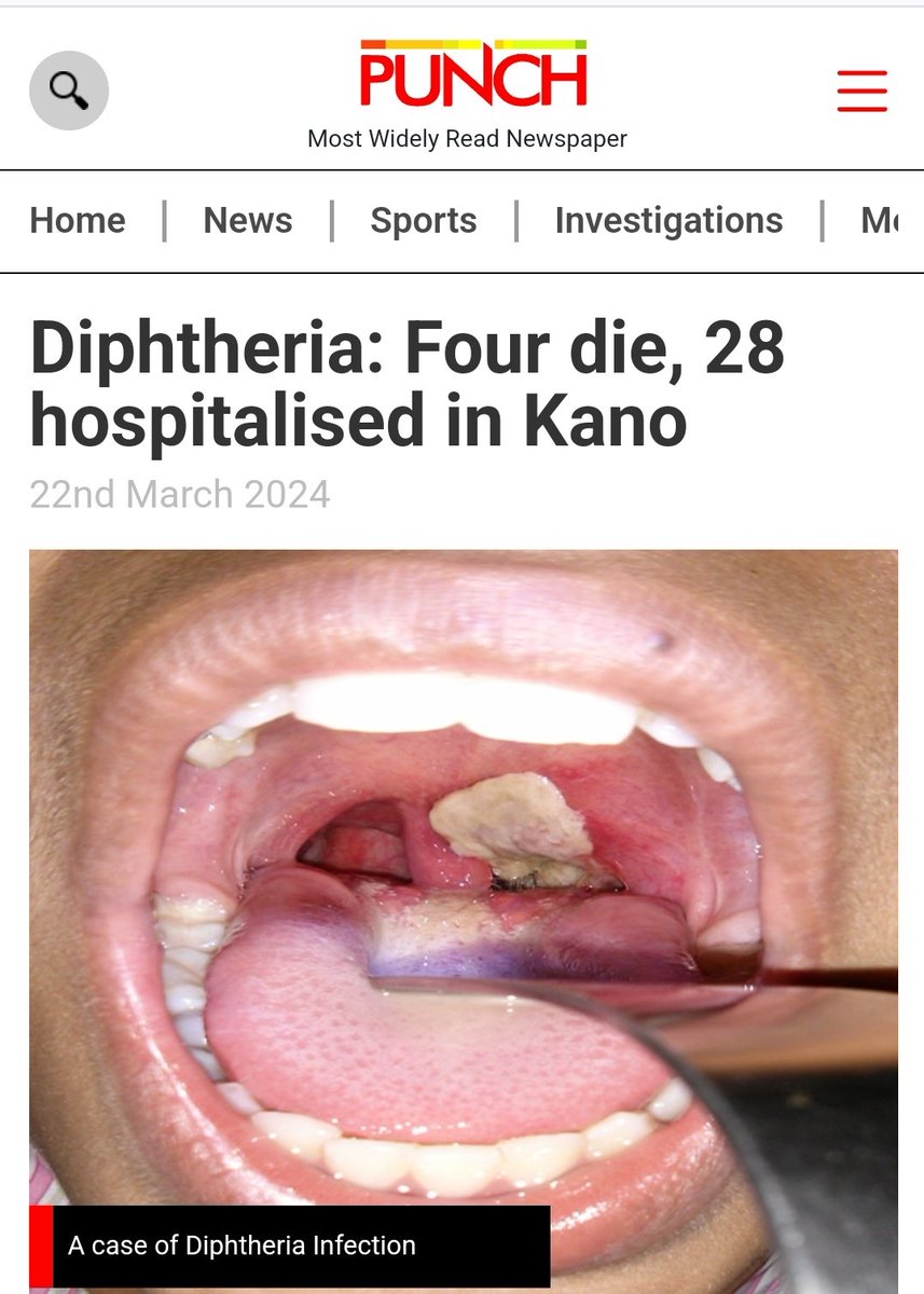 the_beardedsina's tweet photo. URGENT 
Please share if you see this

There is a current outbreak of a disease called DIPHTHERIA in Kano.

4 deaths have been reported and 28 hospitalised.
This is a disease no one envisaged as it is vaccine preventable.

Here are some signs you should know and what to do https://t.co/OGG84HHyC9