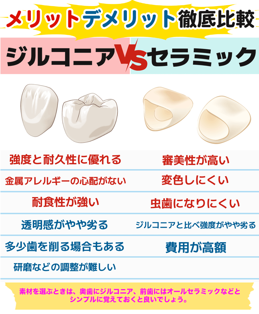【ジルコニアとオールセラミックの違い】
説明できますか？
いずれも同じセラミックの仲間ですが、ジルコニアは強度が高く、割れにくく摩耗しにくい。一方セラミックは、美しさに優れ、耐久性はジルコニアに劣る。奥歯にはジルコニア、前歯にはオールセラミックなどと覚えておくと良いでしょう！
