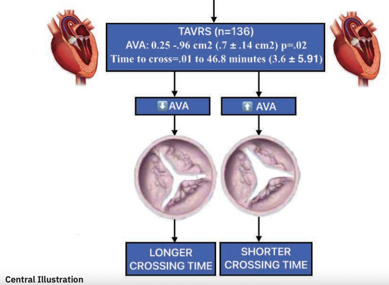 Aortic Valve Area (AVA) and Time to Cross During Transfemoral TAVR Casazza, Fogel, Shani A smaller AVA in patients with aortic stenosis is significantly associated with increased time to cross the aortic valve. okt.to/2ja9Km @InvasiveCardiol #cardiotwitter