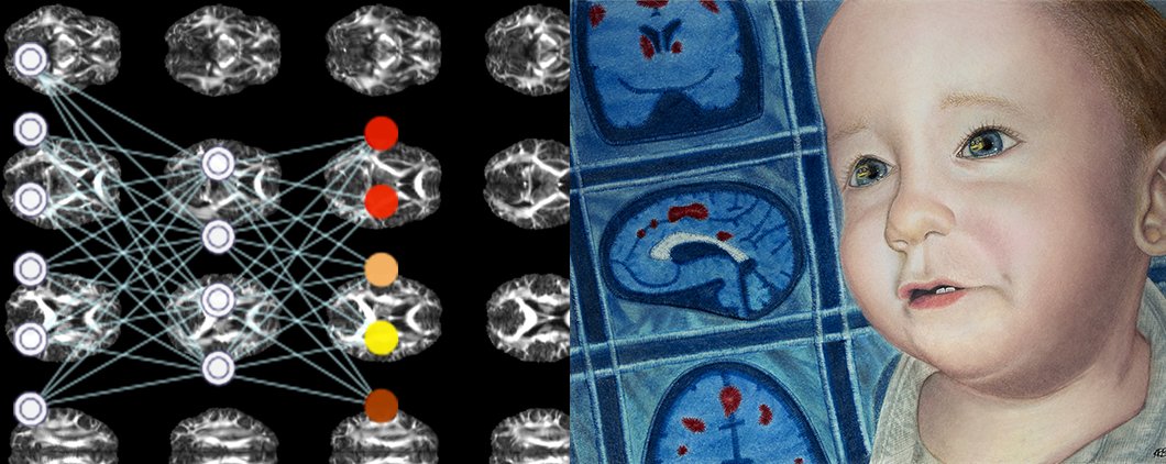 We're seeking three postdocs and two PhDs in infant neuroimaging and medical imaging methods. Join us at the Trinity College Institute of Neuroscience, a state-of-the-art facility in the heart of Dublin, Ireland!
cusacklab.org/vacancies.html
