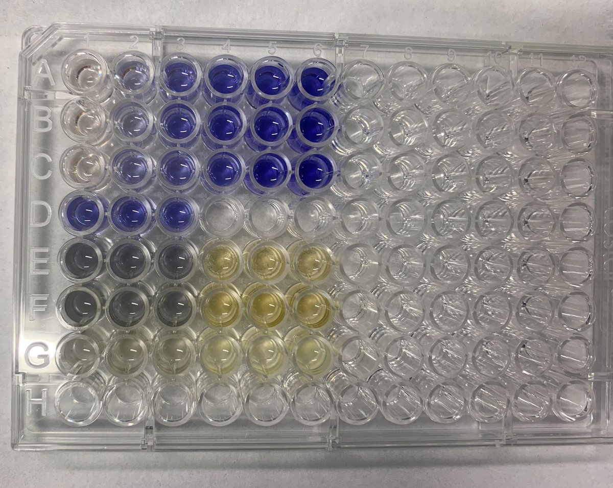 Interesting few weeks, working with students to perform #bioassays on seaweed and #biofilm lipid extracts. Jamie Clarke is conducting the FRAP assay to test antioxidant activity. Fascinating stuff! #ProspecTER #naturalproducts @atusligo_ie  @DCUFSH  @CERIS_ATUSligo @scienceirel