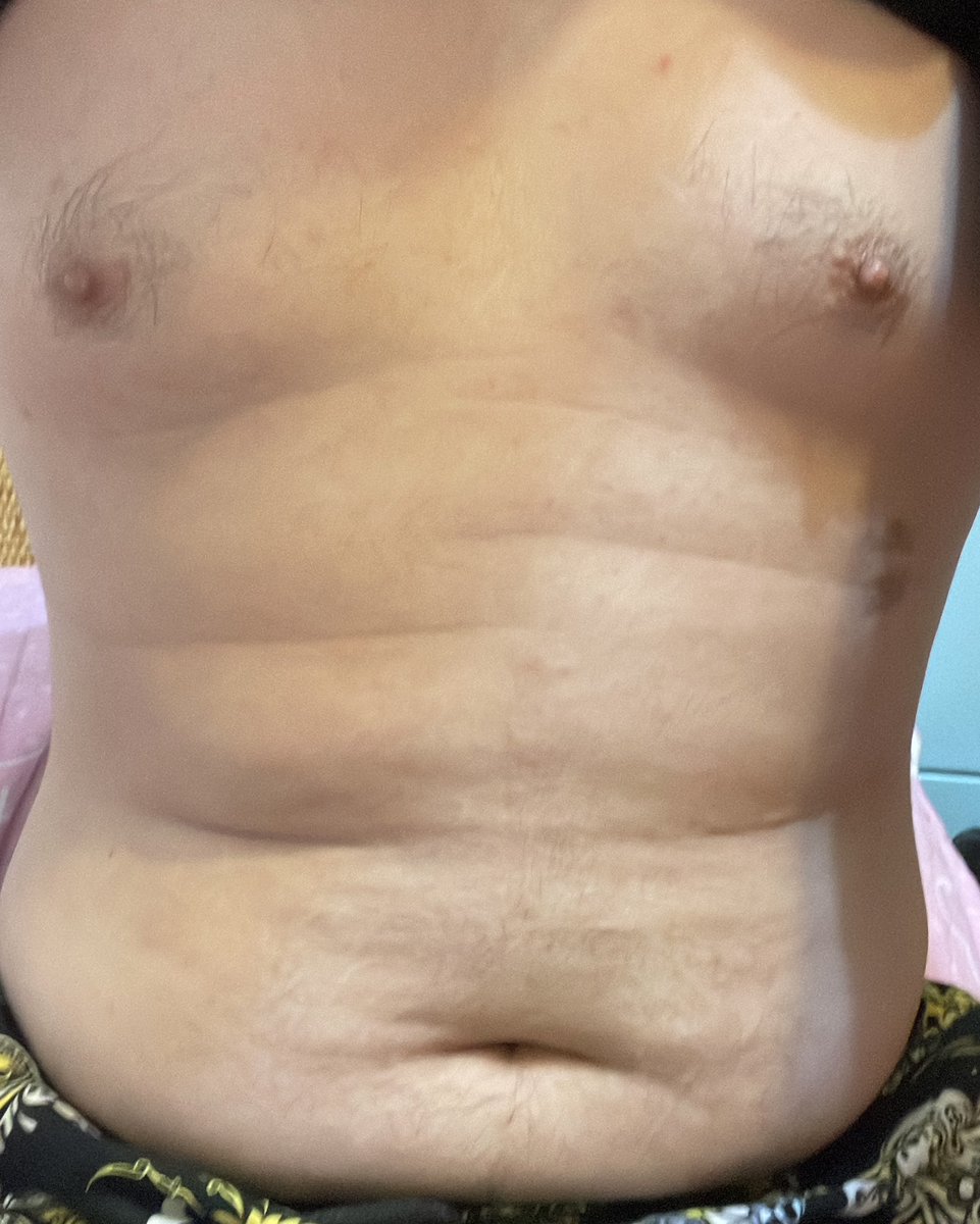 肉熊熊 哈利 (@gary106989) on Twitter photo 