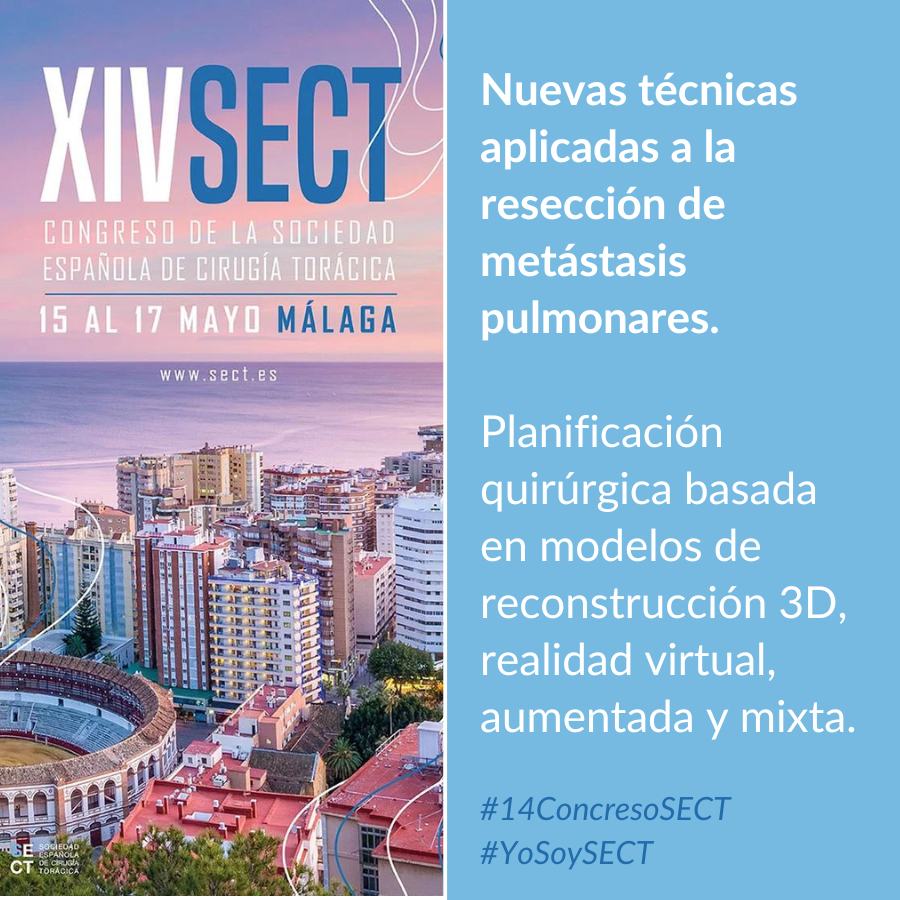 SECTtoracica's tweet image. #14CongresoSECT En la Mesa de “Nuevas técnicas aplicadas a la resección de metástasis pulmonares” disfrutaremos de la ponencia:

Planificación quirúrgica basada en modelos de reconstrucción 3D, realidad virtual, aumentada y mixta.

Programa: sect2024.com/index.php/prog…