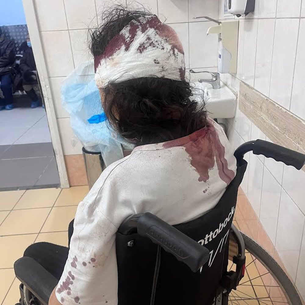 Активисты начали сбор средств для избитой вагнеровцем девушки

В Якутии активисты открыли сбор средств на адвоката девушке: ее, беременную, избил вагнеровец — она потеряла ребенка.

Активистам написала местная жительница и рассказала, как в конце 2023 года была жестоко избита ее