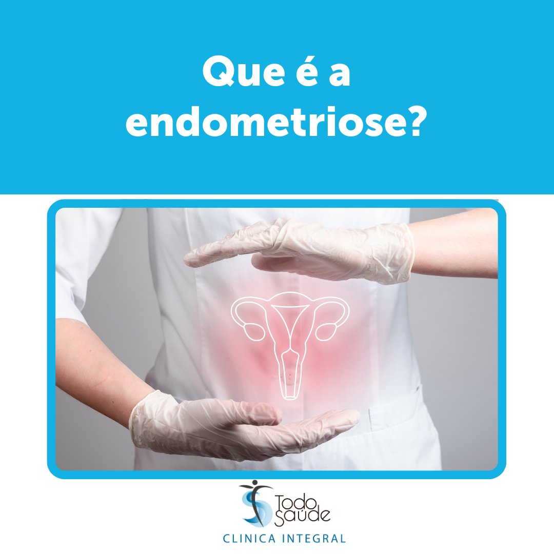 👉 A endometriose é unha enfermidade que afecta a entre un 10% e un 15% da poboación feminina.  

📲 Se tes calquera molestia, desorde ou problemas para quedarte embarazada, non dubides en solicitar cita coa nosa xinecóloga, María Cores Viqueira.  
 
#TodoSaúde #ClínicaTodoSaúde