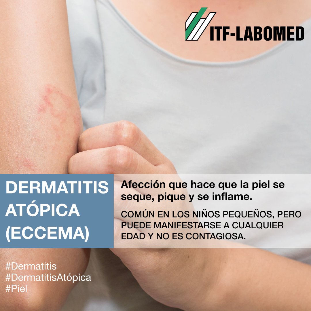 ITFLabomed's tweet photo. 👉La dermatitis atópica (eccema)👈es una afección que hace que la piel se seque, pique y se inflame. 👉Es común en los niños pequeños👈, pero puede manifestarse a cualquier edad y no es contagiosa.
#Dermatitis #DermatitisAtópica #Piel #Saludable #Alimentacion https://t.co/3nAmAzmnC9