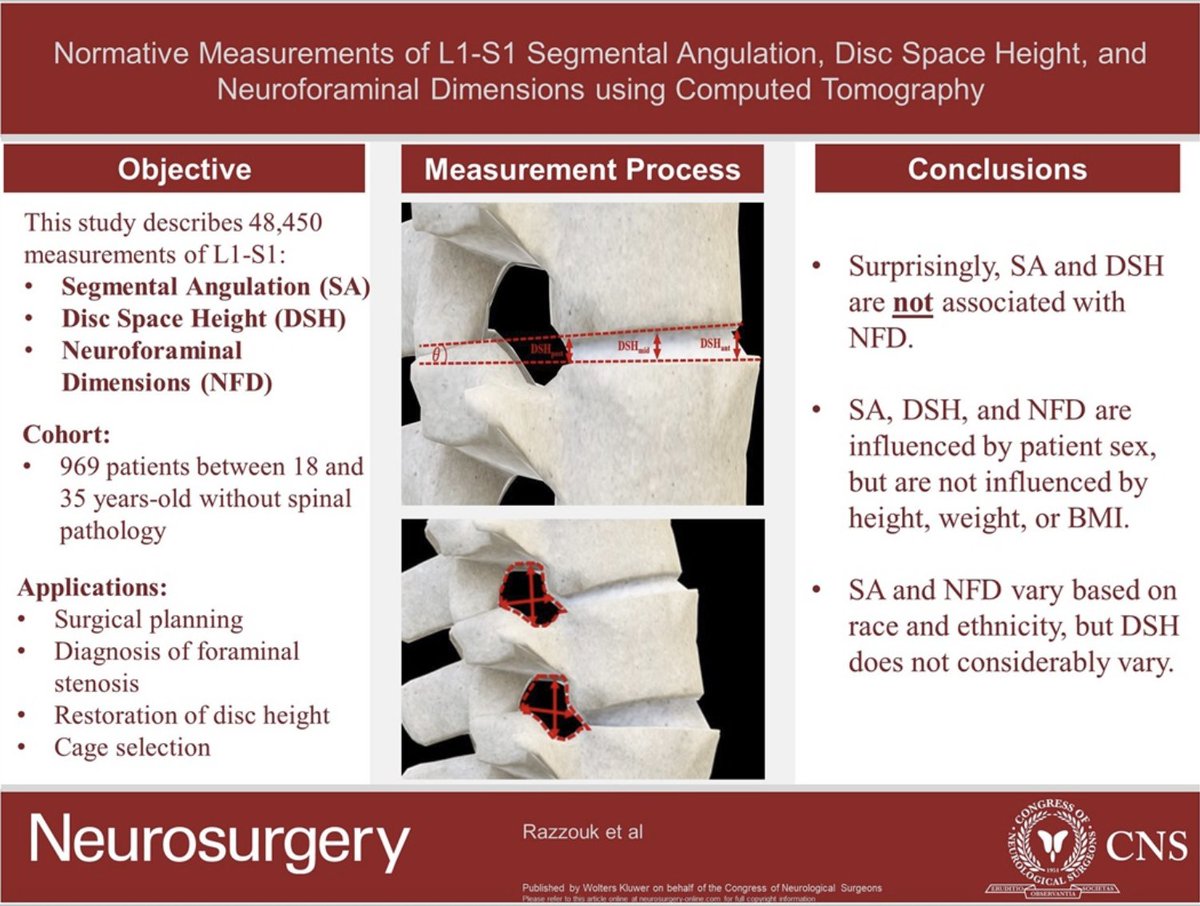 #NEUVisualAbstract Normative Measurements of L1–S1 Segmental Angulation, Disk Space Height, and Neuroforaminal Dimensions Using Computed Tomography bit.ly/4ajYArE @JacobRazzouk @LLUMedSchool @JohnHShinMD @Zaazoue @urquiagajf_MD @LKReedMD @jh_kanterMD @AliAlawiehmdphd