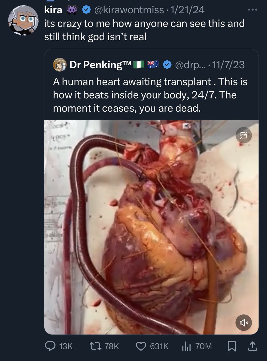 It’s crazy to me how anyone can see this and credit a storybook character for the centuries of human ingenuity & skill development it took to save lives by performing heart transplants.