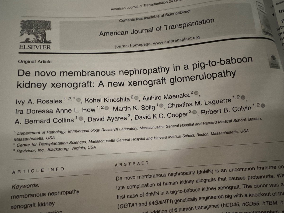 Kidney_dude's tweet photo. @DrDanMO @tommuellerX Not to mention “de novo membranous nephropathy” https://t.co/QG1vfAfCJz