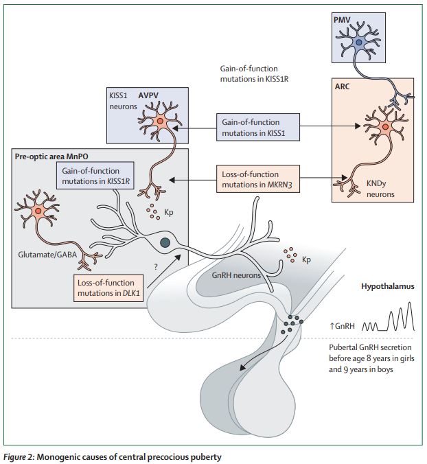 TheLancetEndo's tweet image. This Review is a synoptic up-to-date view of how #puberty is controlled and of the pathogenesis of major pubertal alterations, from both a clinical and translational perspective thelancet.com/journals/landi… 
#neuroendocrine #kisspeptins