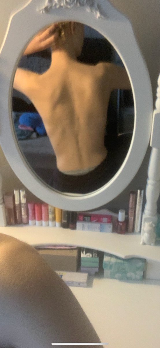 clxrx08's tweet photo. loved my old body hate my new https://t.co/8SXhMTccoF