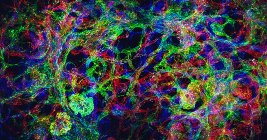 New grant success 🎉 

Dr Jennifer Chandler from <a href="/UCL/">UCL</a> Great Ormond Street Institute of Child Health has received a PhD Studentship grant of £100,000 to understand the potential of targeting blood vessels to treat childhood kidney disease.

Read more 👇

bit.ly/493Ow4W