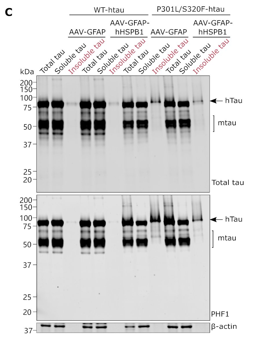 majimsa's tweet photo. And even more interesting, it also reduces mutant tau burden in mouse primary neurons and in brain slices. https://t.co/8mdCpmtZwG