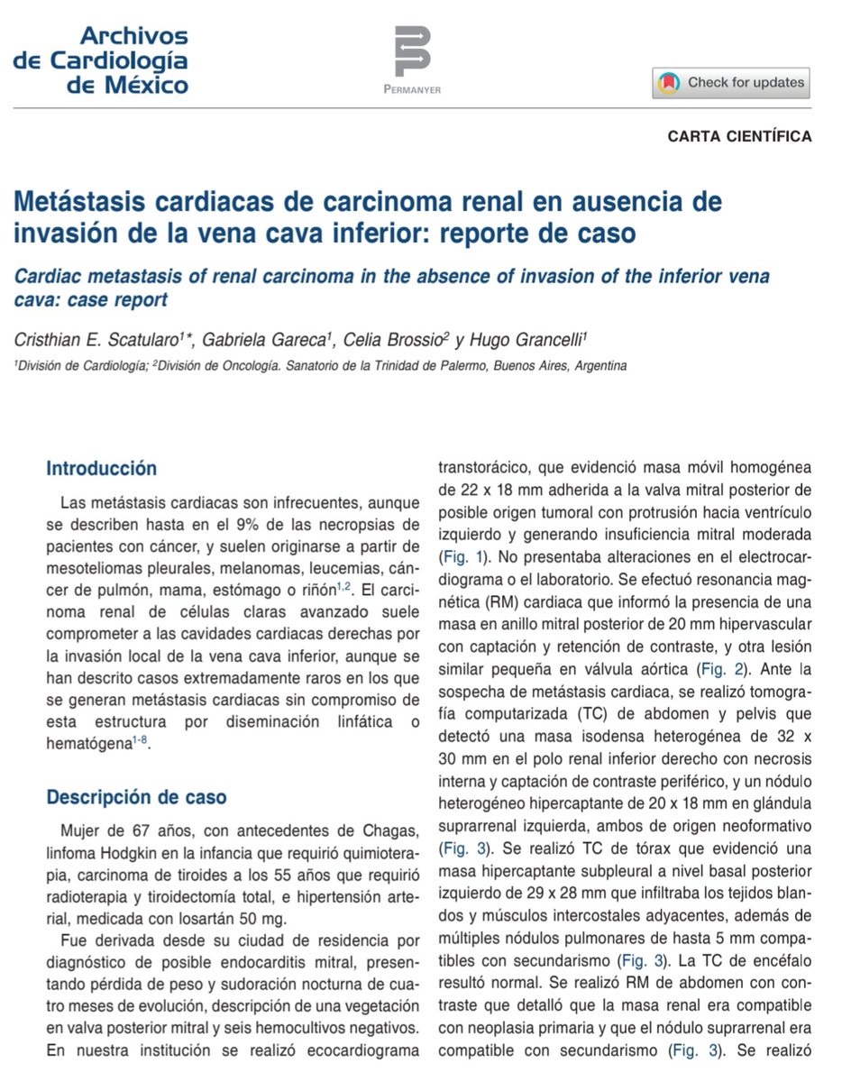 Nuestro reciente aporte en cardio Oncología: Estudio y manejo de un paciente con metástasis cardíaca de CA renal, sin invasión de la vena cava inferior 💡

Free full text ⤵️
archivoscardiologia.com/frame_esp.php?…