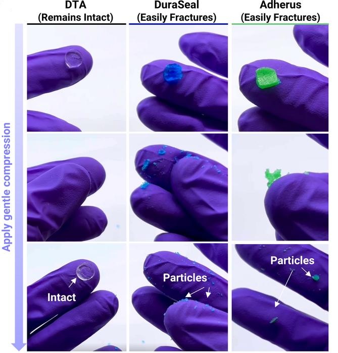 A tough, bioadhesive #hydrogel can reseal the dural membrane surrounding the nervous system during #neurosurgery in large and small animals, offering a suture-less option to lower the risk of complications such as #CSF leakage. @BWHNeurosurgery @KyleWuMD scim.ag/6jU