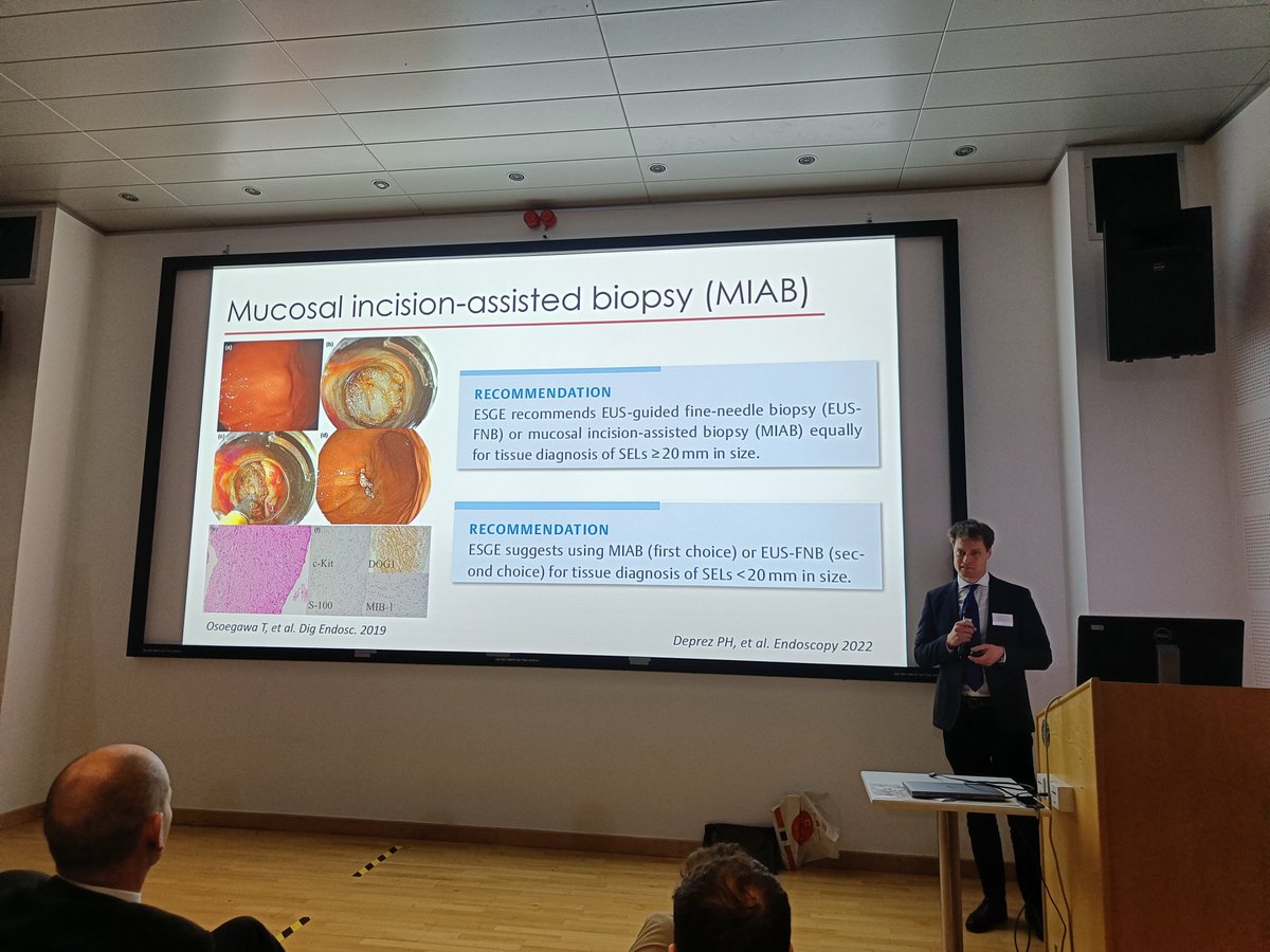 Pradeep Mundre (@pradeepmundre) on Twitter photo 2 key points by <a href="/wladjanu/">Wladyslaw Januszewicz</a>
👉Distal end cap with gastroscope 🟰 duodenoscope for ampullary exam
👉Mucosal incision assisted biopsy is alternate to EUS FNA in Subepithelial lesions <2 cm . 12 th Cambridge UGI sym . My fav accessory is getting some attention <a href="/massi_dipietro/">Massimiliano di Pietro</a> 2 key points by <a href="/wladjanu/">Wladyslaw Januszewicz</a>
👉Distal end cap with gastroscope 🟰 duodenoscope for ampullary exam
👉Mucosal incision assisted biopsy is alternate to EUS FNA in Subepithelial lesions <2 cm . 12 th Cambridge UGI sym . My fav accessory is getting some attention <a href="/massi_dipietro/">Massimiliano di Pietro</a>