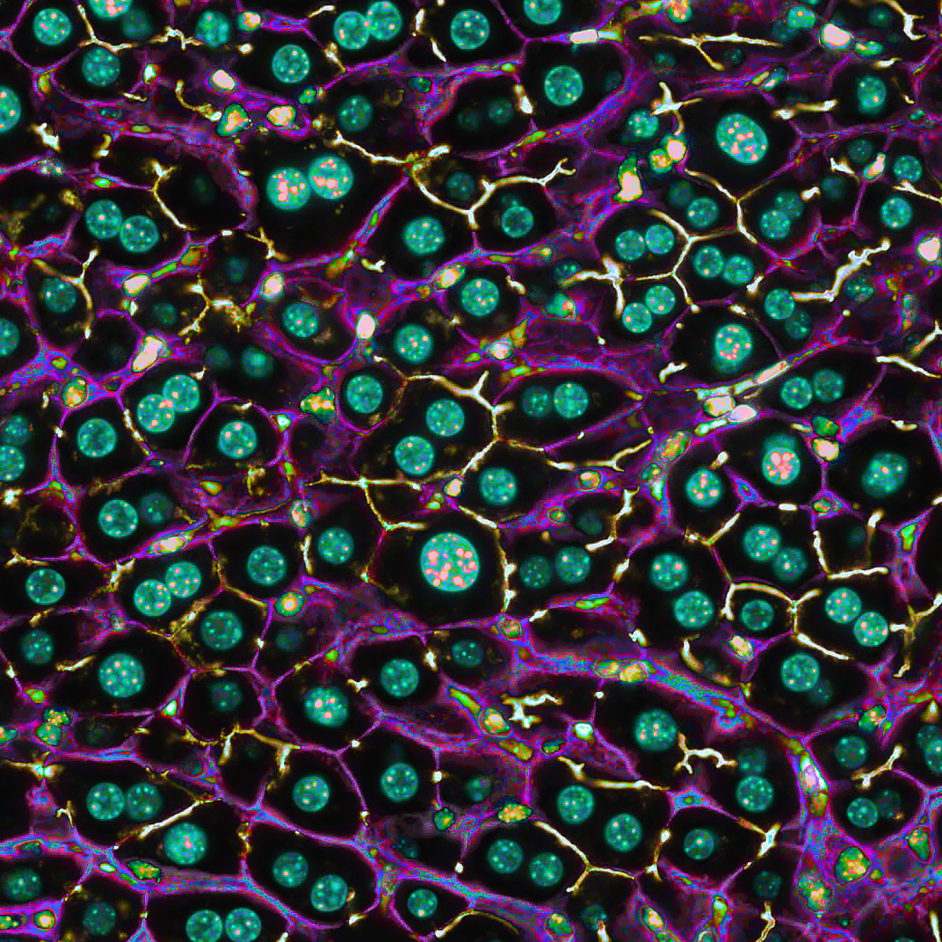 AmyEngevik's tweet photo. Nuclei in the liver are so cute 🤩

#MicroscopyMonday #bioart #sciart #pathart #microscopy #histoart #livertwitter https://t.co/7B2saQhXLz