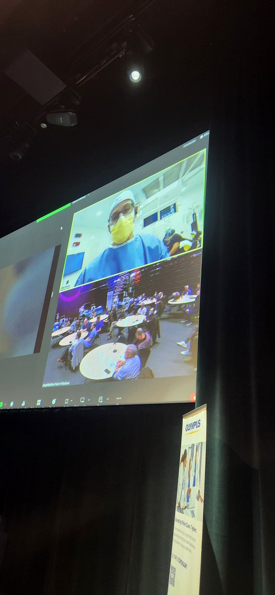 CanUrolAssoc's tweet photo. #CUAmasterclass live from the @CRCHUM TFL enucleation of the prostate &amp;  minimally invasive implants for the surgical management of BPH @NaeemBhojani7 @DrDeanElterman 
@OlympusMedUS  masterclass available on https://t.co/oFl0Kto8gE shortly. https://t.co/LAVogXrySx