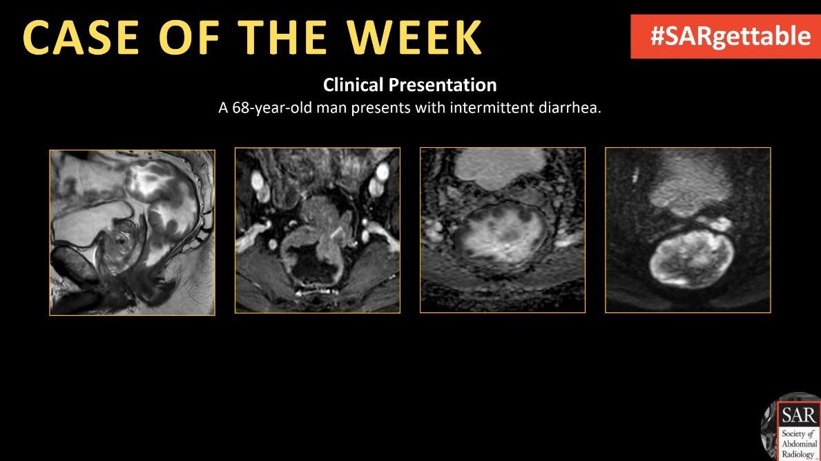 It's time for a new #SARgettable case of the week contributed by <a href="/TaylorLNelson26/">Taylor Nelson</a> and <a href="/EdneyElizabeth/">Elizabeth A Edney</a>. Comment with your diagnosis down below!