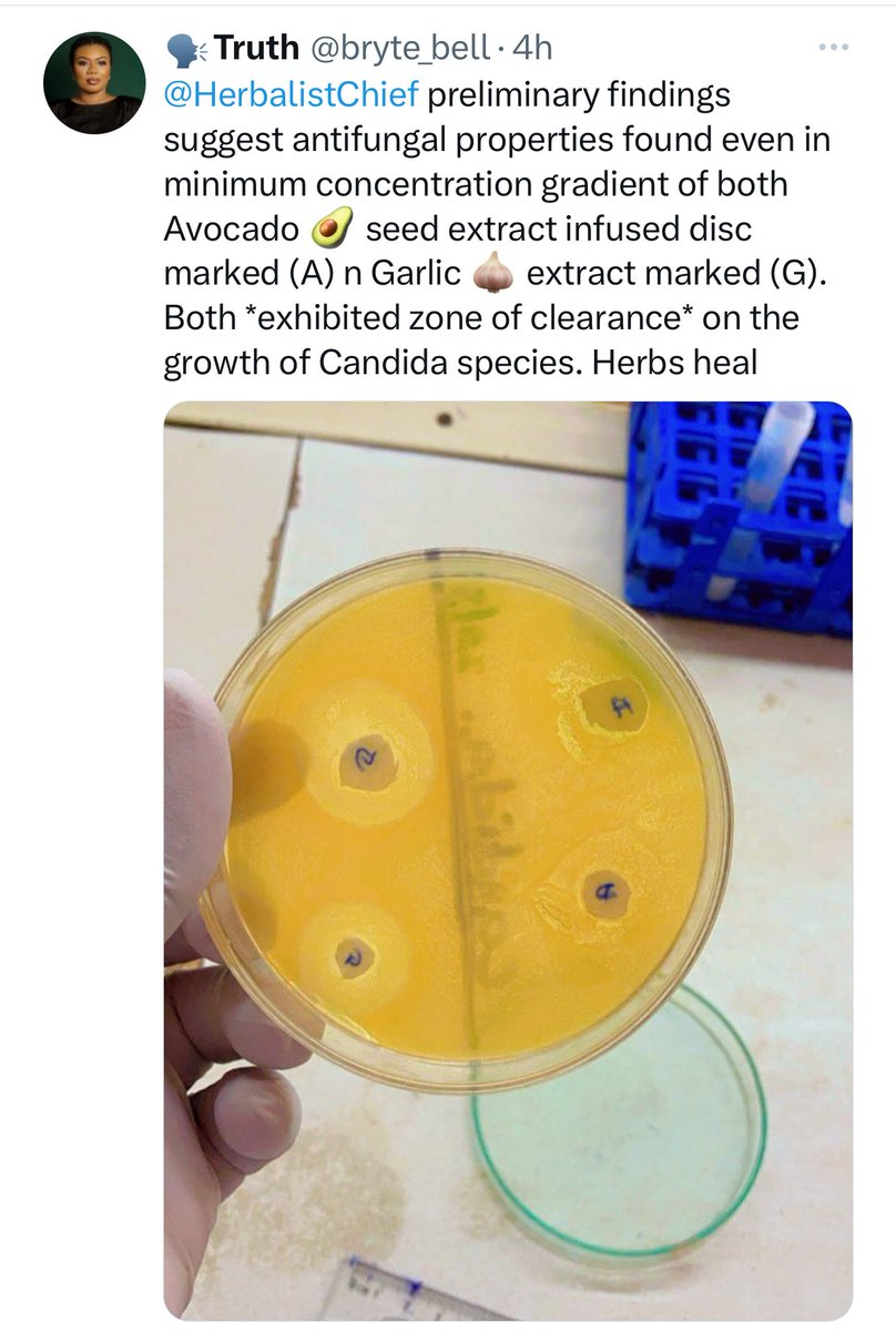 HerbalistChief's tweet photo. A renowned Scientist tested my tweet in his lab to prove whether what I’ve been posting is true or not. 

These were his findings upon testing the minimum concentration of avocado pear seed and garlic plant extracts against candidiasis fungi. 

Nature heals. Thanks @bryte_bell https://t.co/qAC3u2xmof