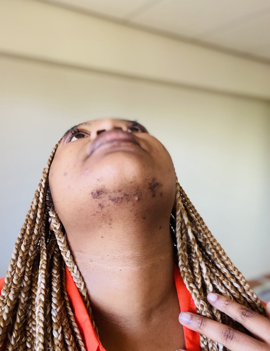 Doctors in the house what makes some ladies grow beards ?