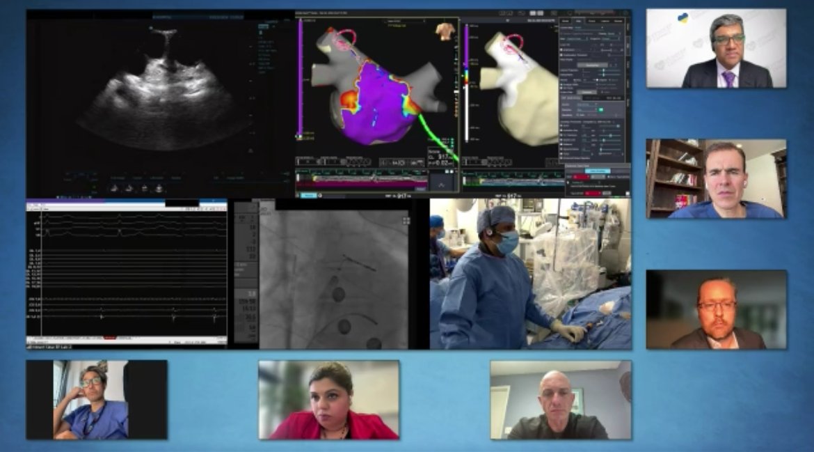 #EPeeps Interesting discussions complement the @ConnectEp live case on strategies to avoid severe acute kidney injury related to hemolysis after PFA for AF. Srinivas Dukkipati @VivekReddyMD @jongichun Frank Cuoco, @drjohndayMD @Drdevignair @KarsNeven