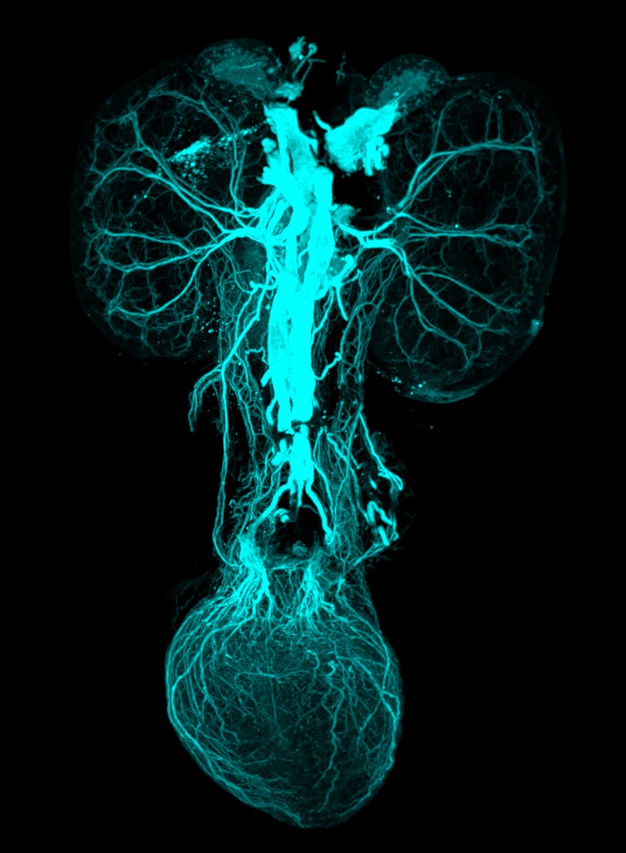 Lori O'Brien (@l_obrien_lab) on Twitter photo For this #FluorescenceFriday, an image showing innervation of the postnatal (P0) kidneys and bladder. Courtesy of postdoc <a href="/S_Ray_09/">Sarah R. McLarnon</a> and grad student <a href="/P_NGUETTA/">Pierre-Emmannuel N’Guetta</a>. For this #FluorescenceFriday, an image showing innervation of the postnatal (P0) kidneys and bladder. Courtesy of postdoc <a href="/S_Ray_09/">Sarah R. McLarnon</a> and grad student <a href="/P_NGUETTA/">Pierre-Emmannuel N’Guetta</a>.