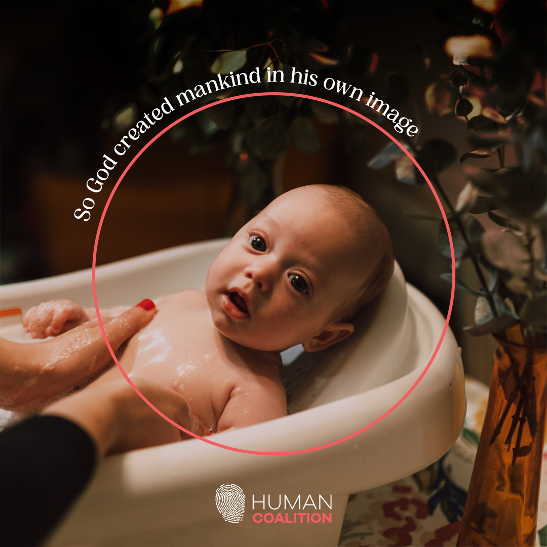 “So God created mankind in his own image, in the image of God he created them; male and female he created them.” Genesis 1:27 #SaveTheBabyHumans #LifeIsAHumanRight #ValueLife #ChooseLife #EndAbortion #Abortion #ProLife #RescueThePreborn #HelpHurtingWomen #HelpTheHurting