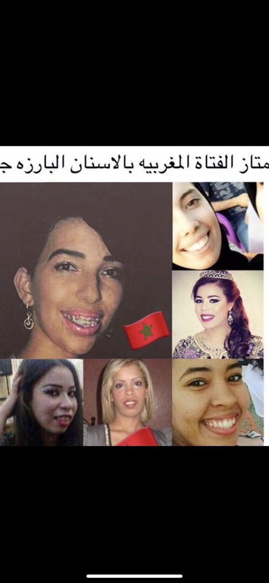 Barbistan1923's tweet photo. @07zil Salva a tu país del SIDA, expúlsalos 🇲🇦 https://t.co/40cKViAa2p