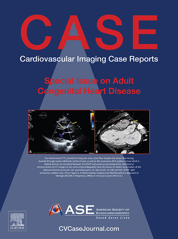 Experts in #CVUltrasound provide insightful cases & sonographer tips each month for ASE’s open access @CASEfromASE. Submit your “aha” case to be included in a future issue! Read the Special #ACHD issue that published March 8. bit.ly/3cXirAZ #HeartofASE #ASEMemberDay