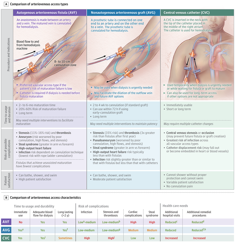 SeguraCardio's tweet photo. 📌Arteriovenous Access for #Hemodialysis
A #Review 

#CardioRenal https://t.co/ZjM78SKGw8