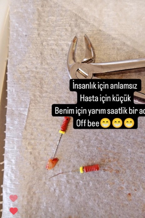 @DisKamu @MHRS_182 @saglikbakanligi Yer ilçe devlet hastanesi. MHRS 15dk.lik randevulardan biri. Yarım saatten fazla süren çekim işlemi. Ağrıyan eller yorulan kollar ve gözler. Sonra sıradaki hasta...