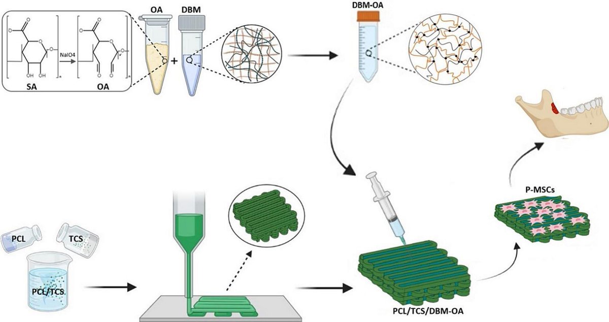 Amirreza Mansoori-Kermani (@amirreza_mans) on Twitter photo Glad to announce that the latest work of my previous lab has been in International Journal of Biological Macromolecules. 3-D printed PCL scaffolds incorporated with tricalcium silicate and decellularized bone matrix for craniofacial bone defects. authors.elsevier.com/c/1ilyBWFfgwyUv Glad to announce that the latest work of my previous lab has been in International Journal of Biological Macromolecules. 3-D printed PCL scaffolds incorporated with tricalcium silicate and decellularized bone matrix for craniofacial bone defects. authors.elsevier.com/c/1ilyBWFfgwyUv