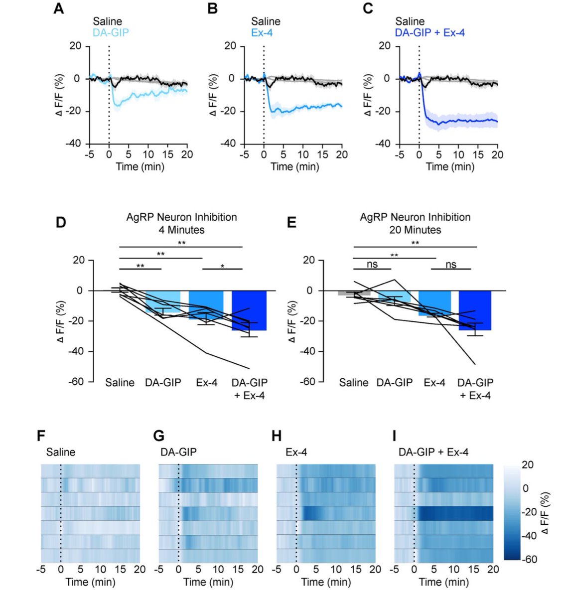 Daniel J Drucker (@danieljdrucker) on Twitter photo New from @lbeutler7 Delineation of how GIP vs. GLP-1 inhibits Agrp neurons biorxiv.org/content/10.110… #weightloss <a href="/NUFeinbergMed/">Northwestern Feinberg School of Medicine</a> New from @lbeutler7 Delineation of how GIP vs. GLP-1 inhibits Agrp neurons biorxiv.org/content/10.110… #weightloss <a href="/NUFeinbergMed/">Northwestern Feinberg School of Medicine</a>