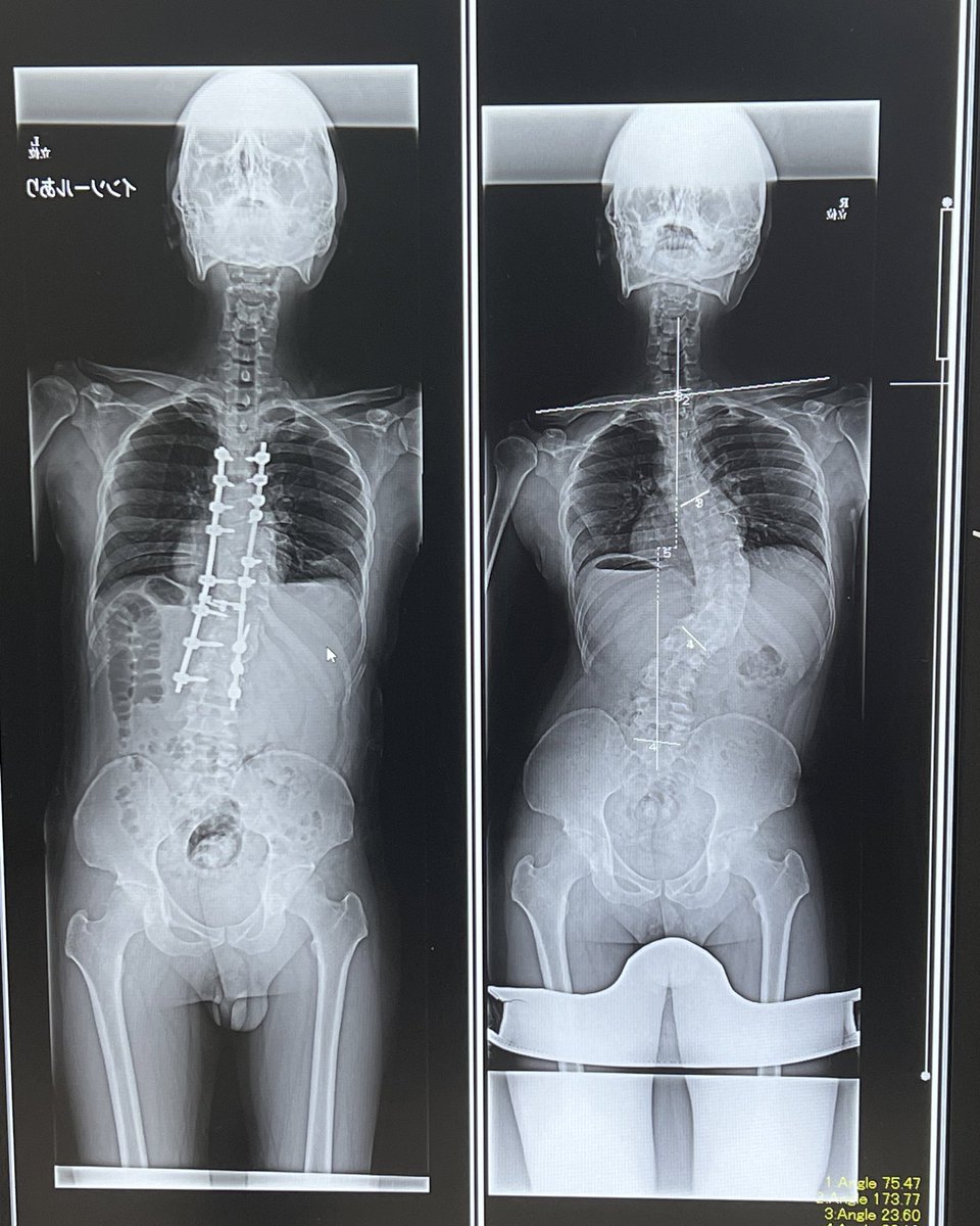 ともりん mqdefault.jpg